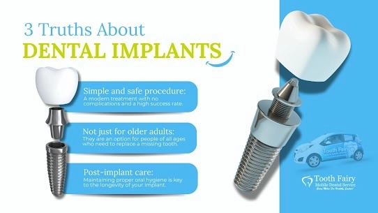 Dental Implants: The Long-Lasting Solution for Missing Teeth | Tooth Fairy Mobile Dental Services